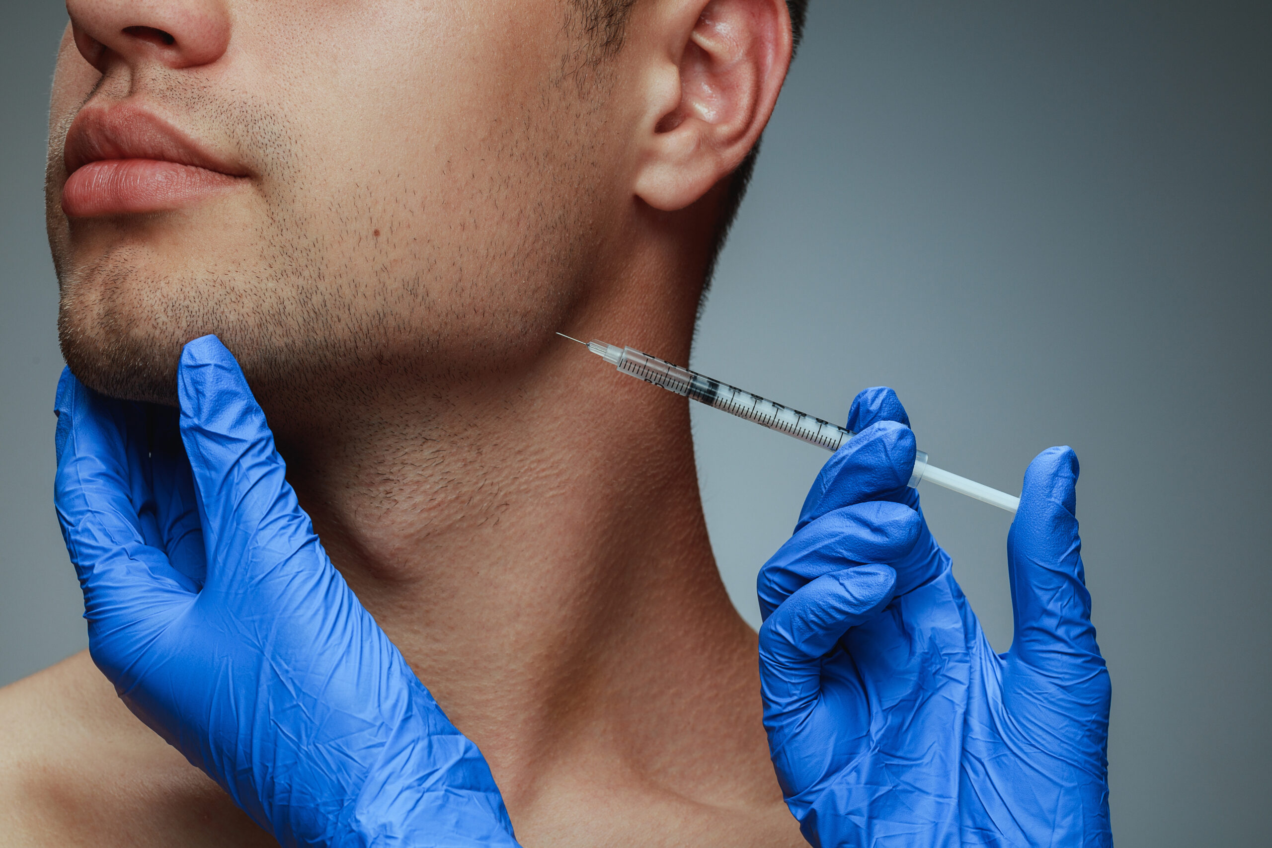 TMJ botox in San Diego, CA 