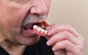 hybrid dentures